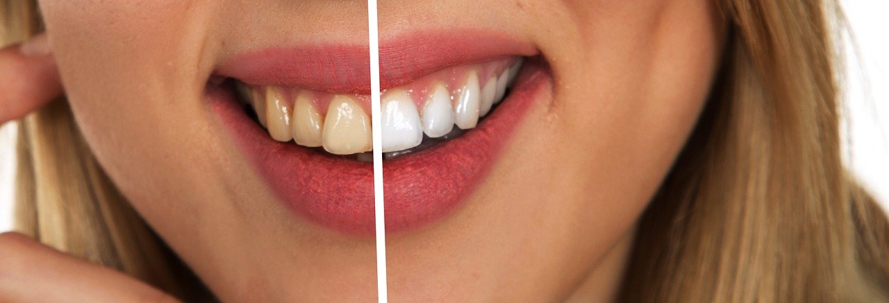 Dentiste esthétique Paris