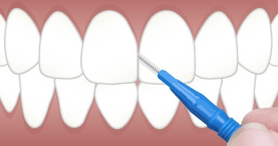 Hygiène Dentaire : ce qu’il faut savoir le brossage de dents